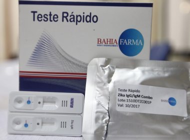 Ministério vai comprar kits para diagnosticar zika de laboratório baiano
