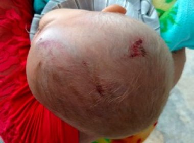 Criança de três anos é morta e bebê é agredido a pauladas pelo tio em Várzea Nova