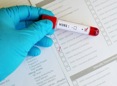 Guanambi: Secretaria de Saúde do município confirma primeira morte por H1N1