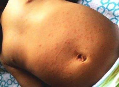 Descoberta de zika vírus e morte de prefeito no interior da Bahia marcaram abril