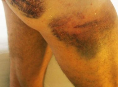 Jornalista é agredido por guardas municipais do Rio de Janeiro ao filmar confusão