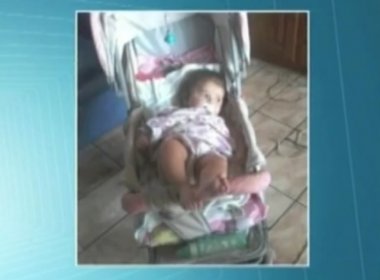 Bebê de oito meses morre após ser mordido por pitbull no Pará
