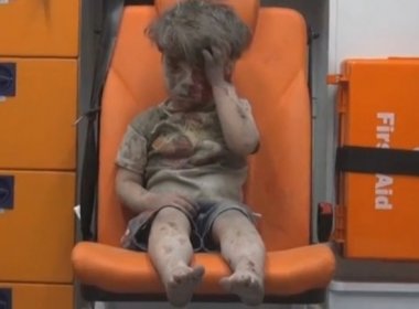 Menino sobrevive a ataque aéreo e vira símbolo de guerra na Síria; veja vídeo