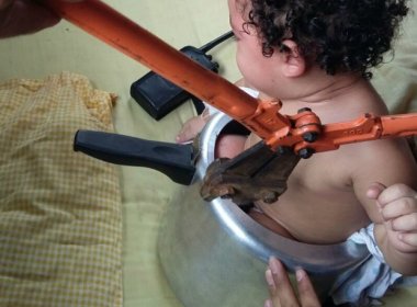 Após brincadeira, bebê de 1 ano fica presa em panela de pressão