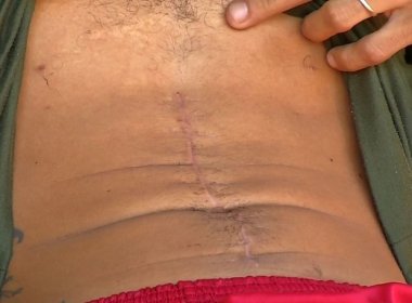 Homem passa por cirurgia para retirar bala e sai de hospital sem rim em Rondonópolis