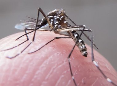 Brasil registra 3.174 casos suspeitos de microcefalia relacionados ao Zika Vírus