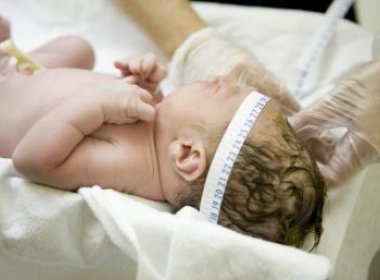 Bebês com microcefalia receberão salário mínimo mensalmente