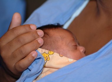 Osid divulga aumento acentuado nos atendimentos de bebês com microcefalia