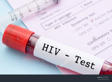 Vacina contra HIV será testada em 5.400 pessoas na África do Sul