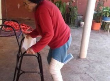 Médicos enfaixam perna de idosa por cima da calça e tênis: 'Tudo empelotado'