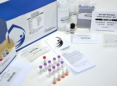 Anvisa libera teste que permite diagnóstico simultâneo de zika, dengue e chikungunya