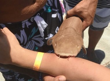 Tubarão ataca mulher e vítima é socorrida ao hospital com animal preso ao seu braço