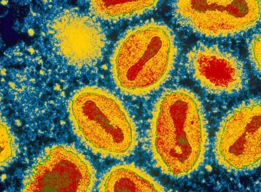 Reino Unido registra mais dois casos de infecção rara de varíola